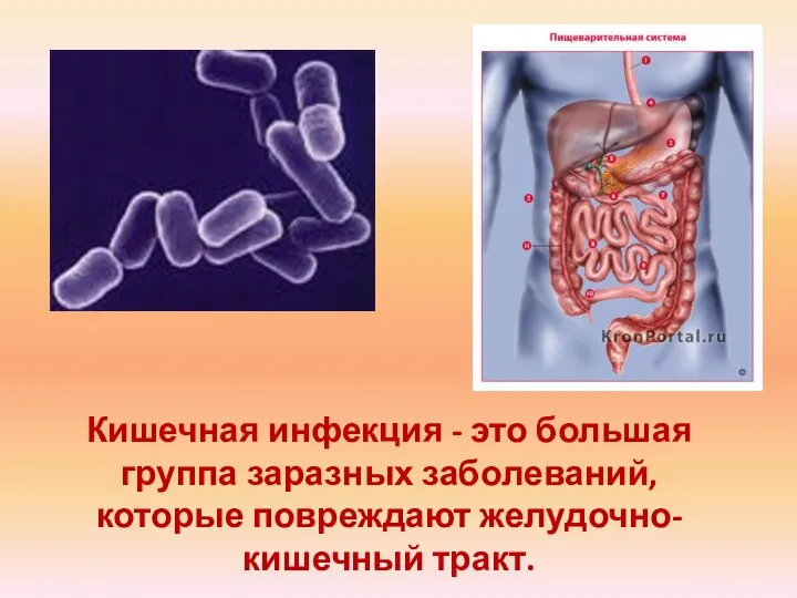 Кишечная инфекция - это большая группа заразных заболеваний, которые повреждают желудочно-кишечный тракт.