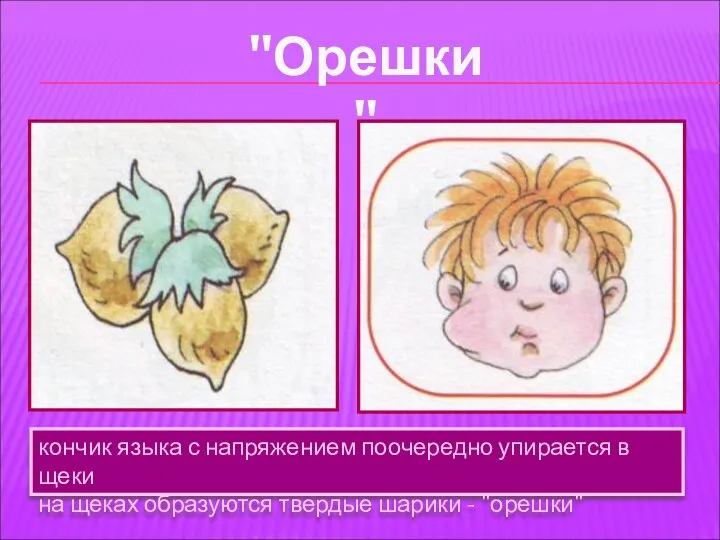 кончик языка с напряжением поочередно упирается в щеки на щеках образуются твердые шарики - "орешки" "Орешки"