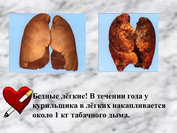 Бедные лёгкие! В течении года у курильщика в лёгких накапливается около 1 кг табачного дыма.