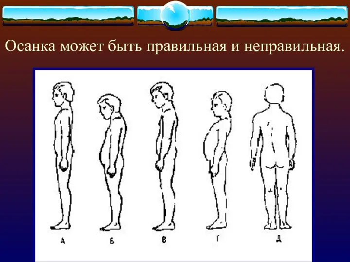 Осанка может быть правильная и неправильная.