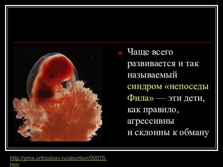 Чаще всего развивается и так называемый синдром «непоседы Фила» — эти