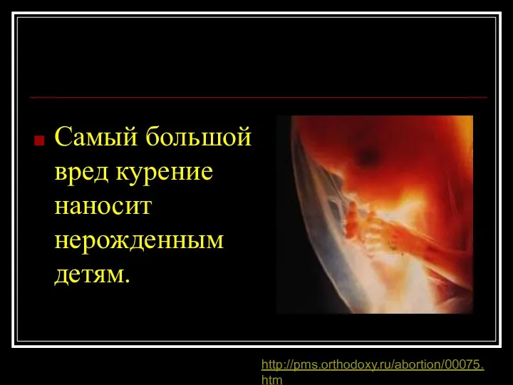 Самый большой вред курение наносит нерожденным детям. http://pms.orthodoxy.ru/abortion/00075.htm