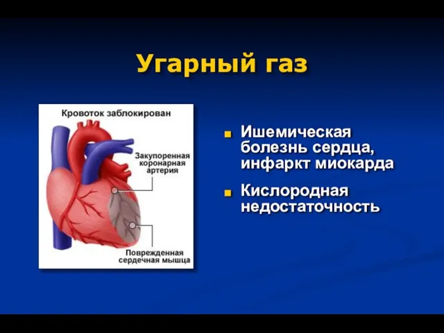 Угарный газ Ишемическая болезнь сердца, инфаркт миокарда Кислородная недостаточность