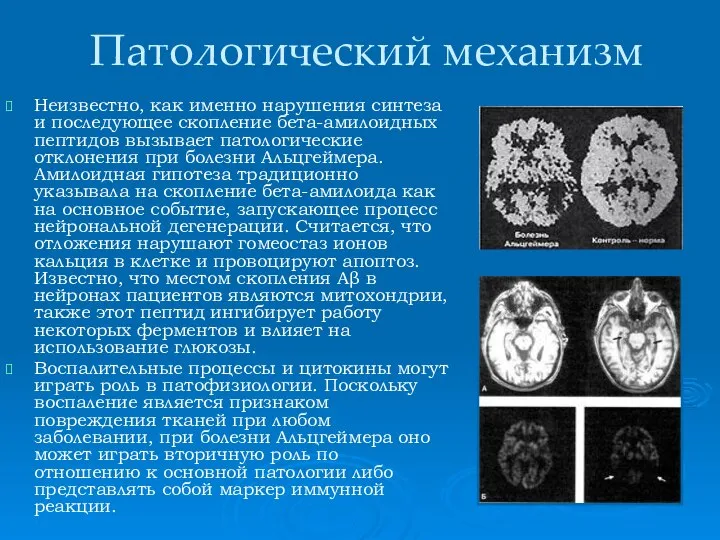 Патологический механизм Неизвестно, как именно нарушения синтеза и последующее скопление бета-амилоидных