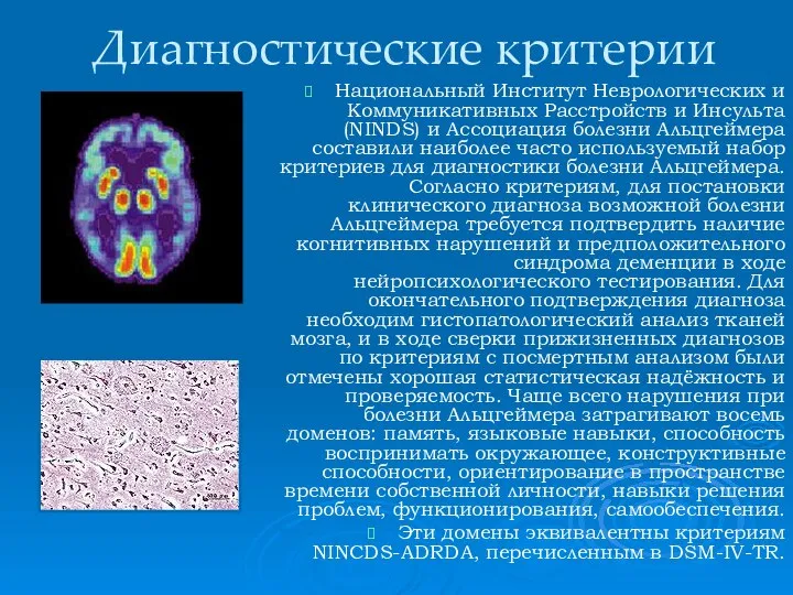 Диагностические критерии Национальный Институт Неврологических и Коммуникативных Расстройств и Инсульта (NINDS)