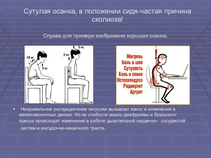 Сутулая осанка, в положении сидя-частая причина сколиоза! Справа для примера изображена