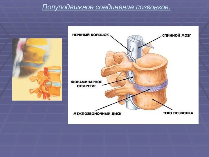 Полуподвижное соединение позвонков.