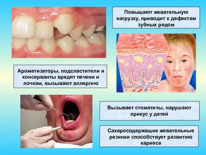 Повышают жевательную нагрузку, приводит к дефектам зубных рядом Сахаросодержащие жевательные резинки