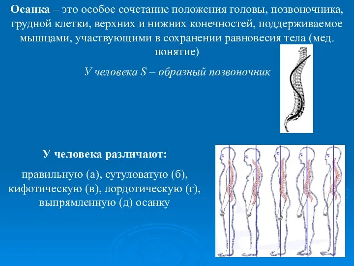 Осанка – это особое сочетание положения головы, позвоночника, грудной клетки, верхних