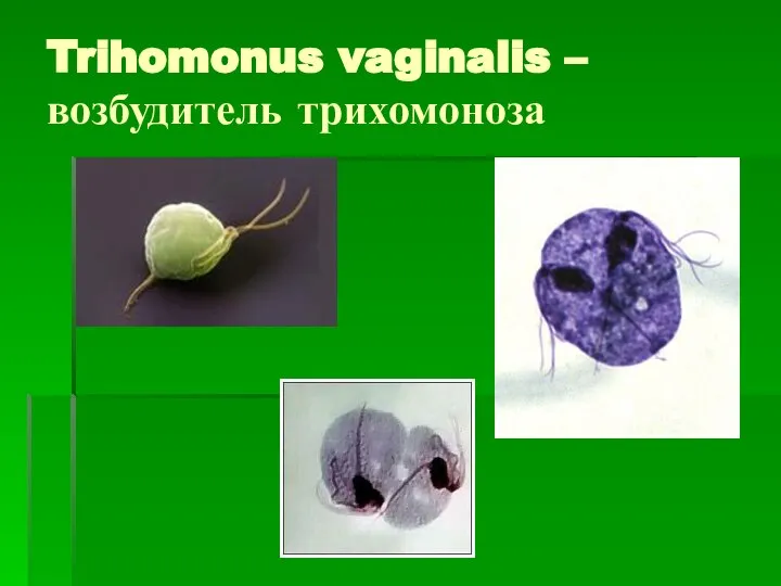 Trihomonus vaginalis – возбудитель трихомоноза