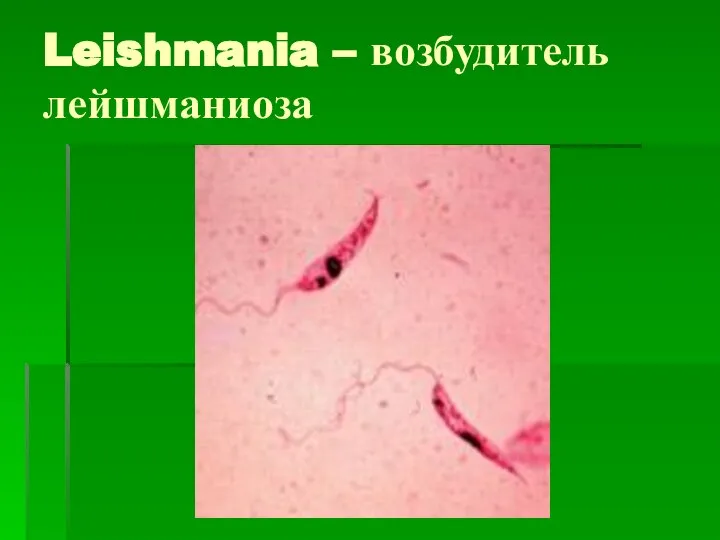 Leishmania – возбудитель лейшманиоза