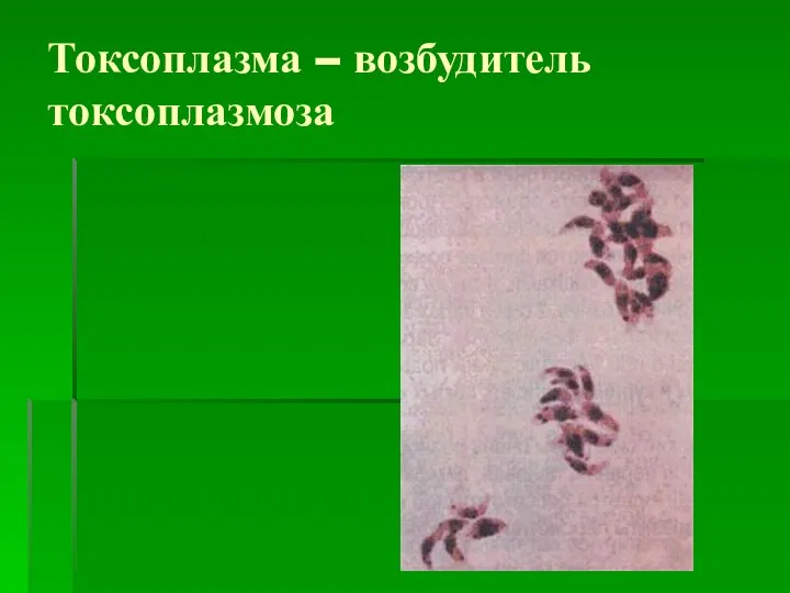 Токсоплазма – возбудитель токсоплазмоза