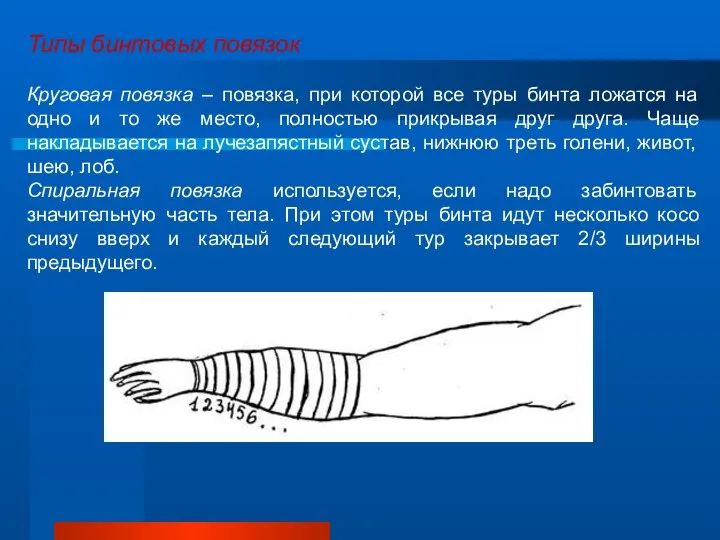 Типы бинтовых повязок Круговая повязка – повязка, при которой все туры