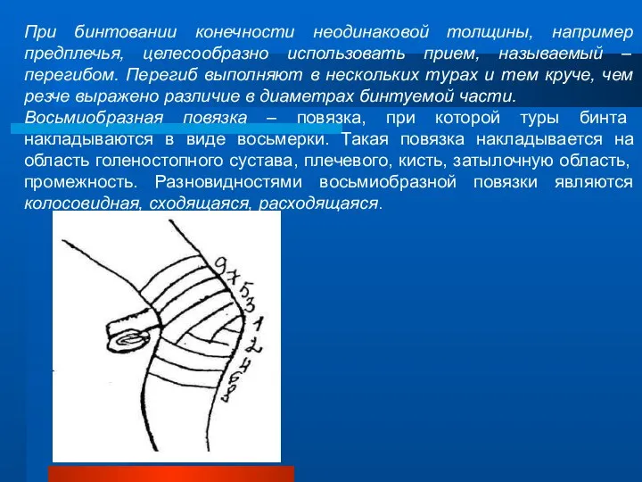 При бинтовании конечности неодинаковой толщины, например предплечья, целесообразно использовать прием, называемый