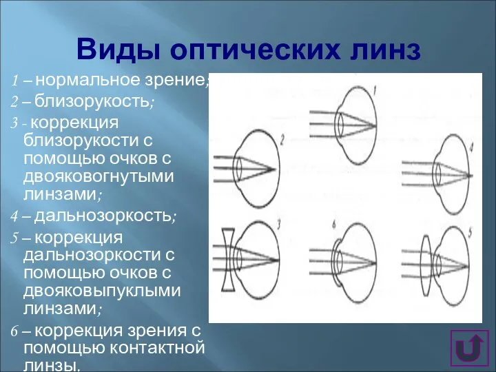 Виды оптических линз 1 – нормальное зрение; 2 – близорукость; 3