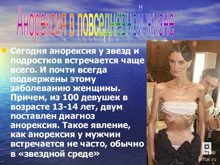 Сегодня анорексия у звезд и подростков встречается чаще всего. И почти