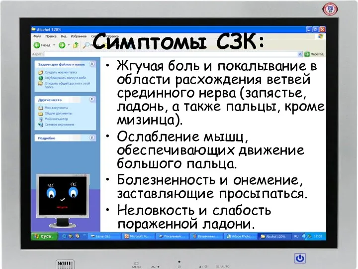 Симптомы СЗК: Жгучая боль и покалывание в области расхождения ветвей срединного