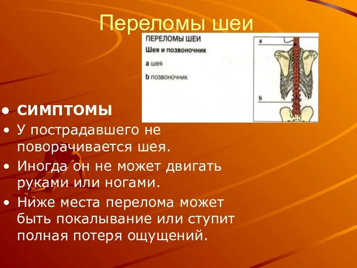 Переломы шеи СИМПТОМЫ У пострадавшего не поворачивается шея. Иногда он не