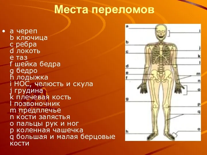 Места переломов а череп b ключица с ребра d локоть е