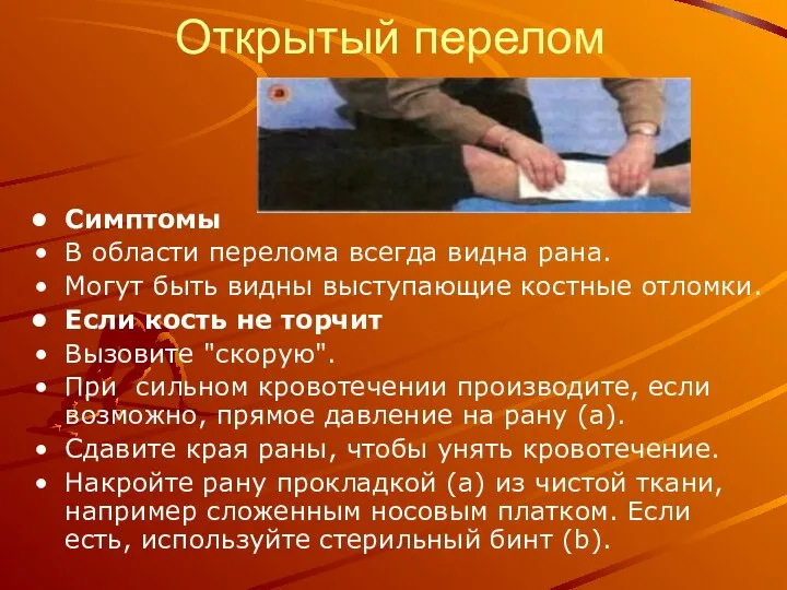 Открытый перелом Симптомы В области перелома всегда видна рана. Могут быть