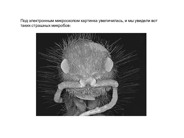 Под электронным микроскопом картинка увеличилась, и мы увидели вот таких страшных микробов: