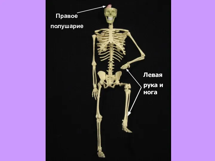 Правое полушарие Левая рука и нога