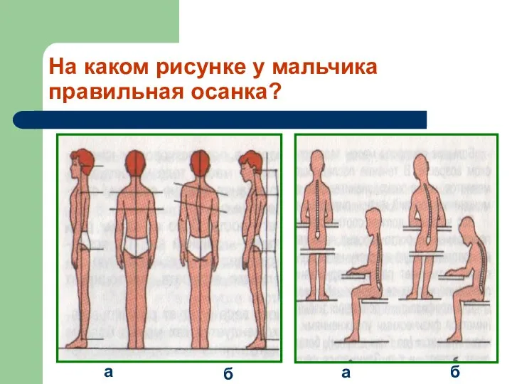 На каком рисунке у мальчика правильная осанка? а б а б