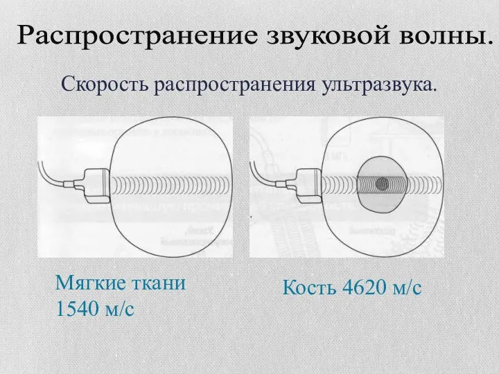 Мягкие ткани 1540 м/с Кость 4620 м/с Скорость распространения ультразвука. Распространение звуковой волны.