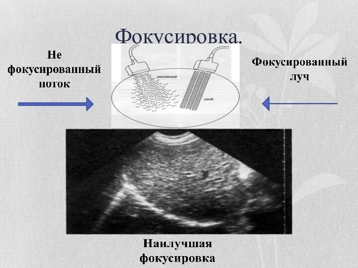 Фокусировка.