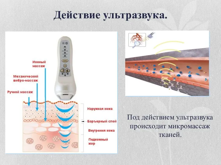 Действие ультразвука. Под действием ультразвука происходит микромассаж тканей.