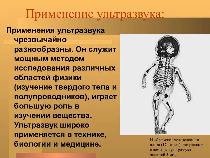 Применение ультразвука: Применения ультразвука чрезвычайно разнообразны. Он служит мощным методом исследования