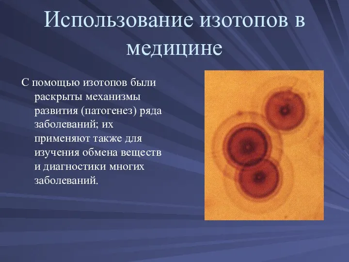 Использование изотопов в медицине С помощью изотопов были раскрыты механизмы развития