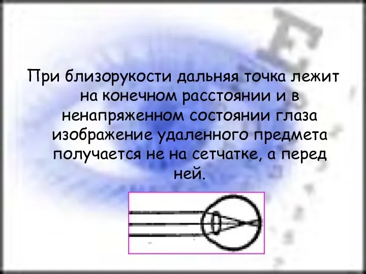 При близорукости дальняя точка лежит на конечном расстоянии и в ненапряженном