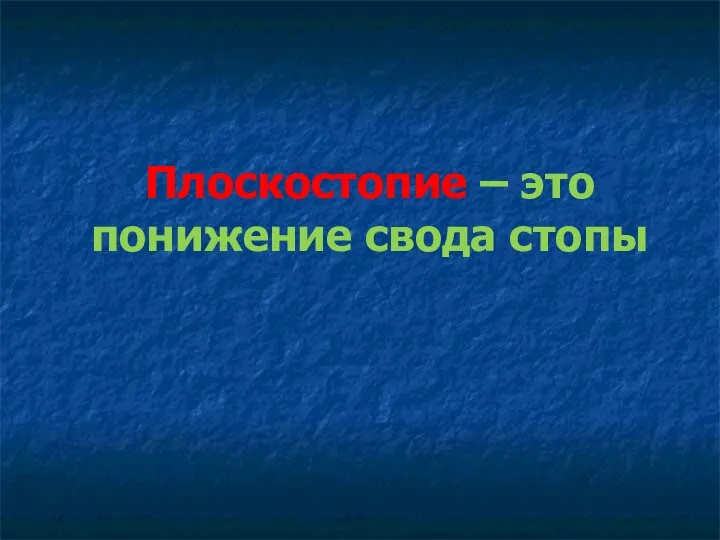 Плоскостопие – это понижение свода стопы