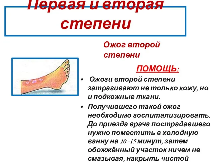 Первая и вторая степени Ожог второй степени ПОМОЩЬ: Ожоги второй степени