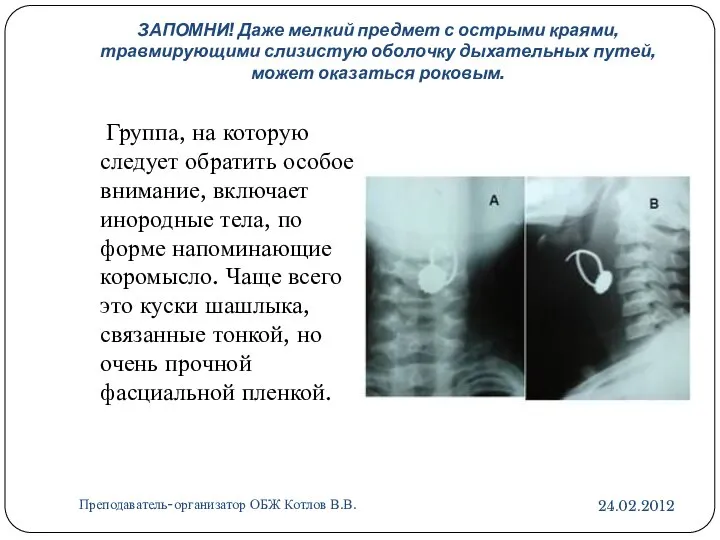 ЗАПОМНИ! Даже мелкий предмет с острыми краями, травмирующими слизистую оболочку дыхательных