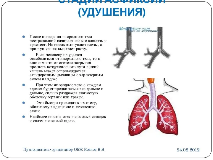 СТАДИИ АСФИКСИИ (УДУШЕНИЯ) Преподаватель-организатор ОБЖ Котлов В.В. После попадания инородного тела