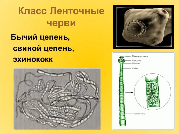 Класс Ленточные черви Бычий цепень, свиной цепень, эхинококк