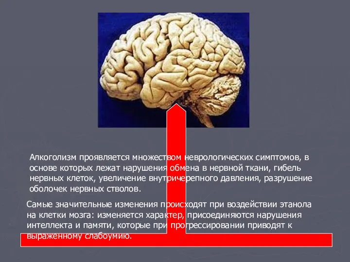 Алкоголизм проявляется множеством неврологических симптомов, в основе которых лежат нарушения обмена