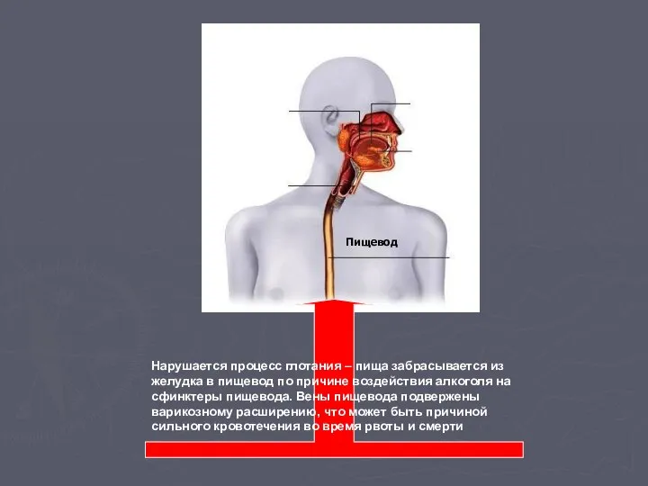 Пищевод Нарушается процесс глотания – пища забрасывается из желудка в пищевод