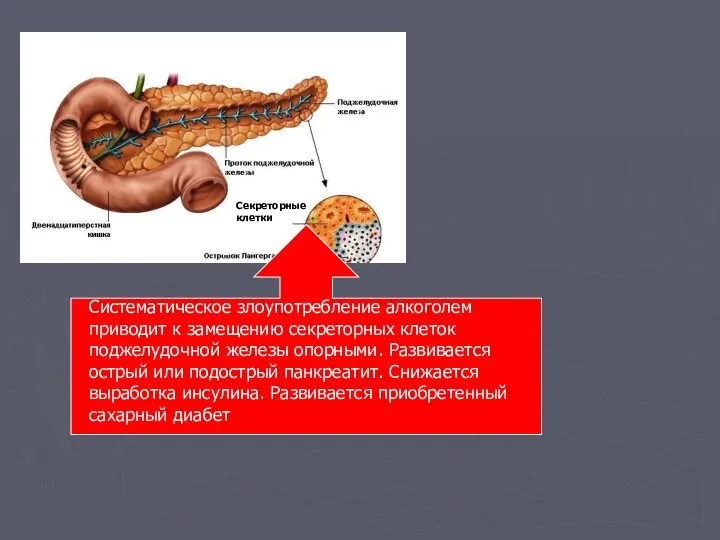 Секреторные клетки Систематическое злоупотребление алкоголем приводит к замещению секреторных клеток поджелудочной