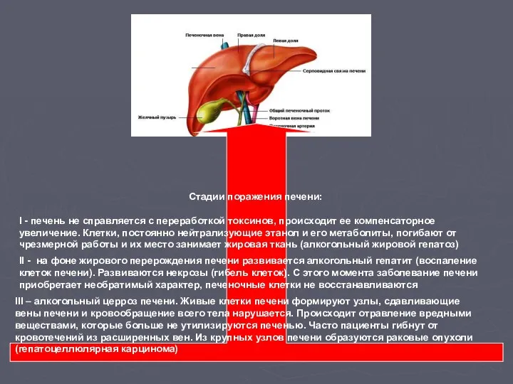 Стадии поражения печени: I - печень не справляется с переработкой токсинов,