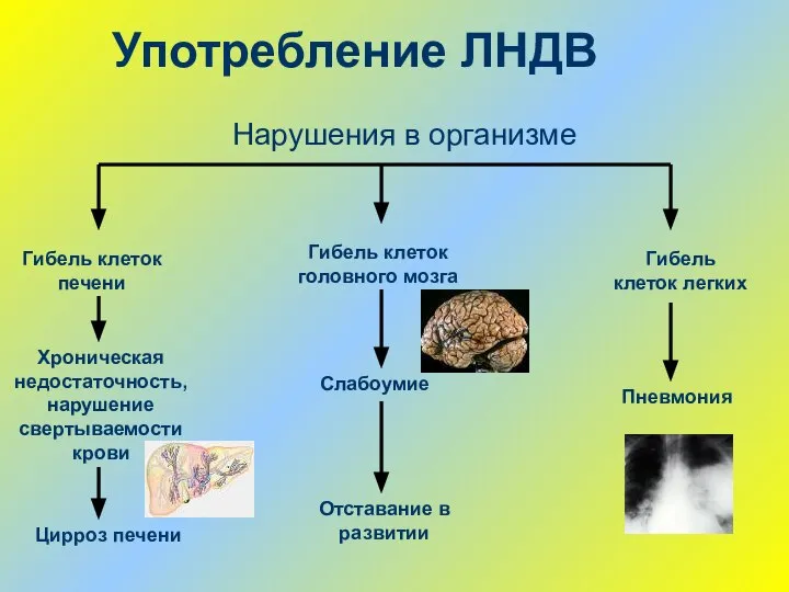 Употребление ЛНДВ Гибель клеток печени Хроническая недостаточность, нарушение свертываемости крови Цирроз