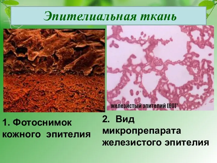 Эпителиальная ткань 1. Фотоснимок кожного эпителия 2. Вид микропрепарата железистого эпителия