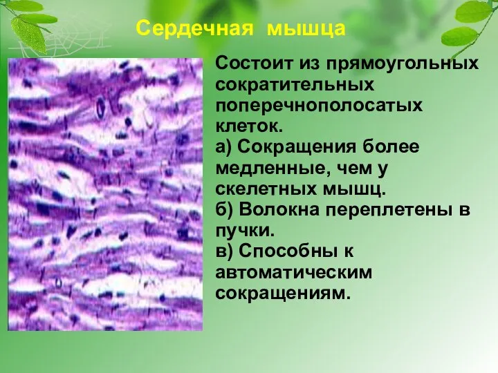 Сердечная мышца Состоит из прямоугольных сократительных поперечнополосатых клеток. а) Сокращения более