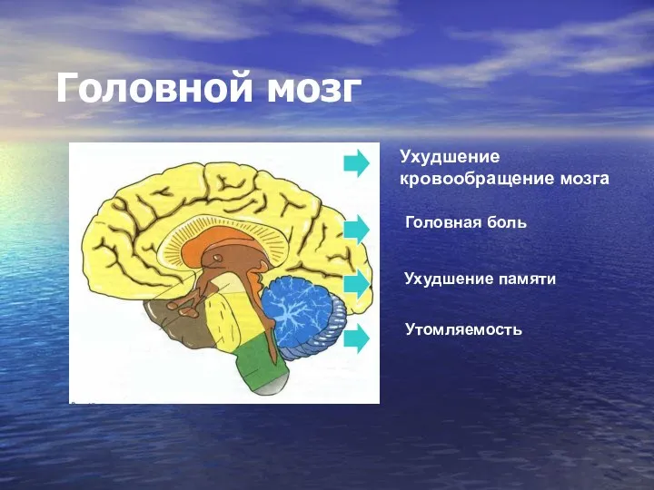 Головной мозг Ухудшение кровообращение мозга Головная боль Ухудшение памяти Утомляемость