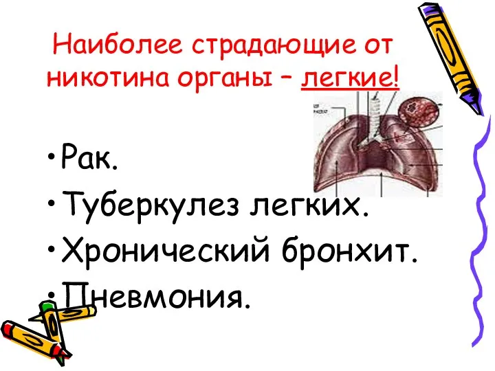 Наиболее страдающие от никотина органы – легкие! Рак. Туберкулез легких. Хронический бронхит. Пневмония.