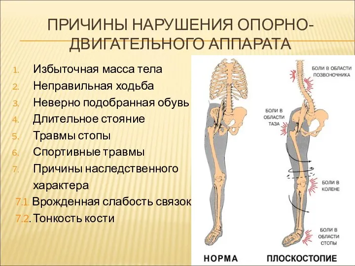 ПРИЧИНЫ НАРУШЕНИЯ ОПОРНО-ДВИГАТЕЛЬНОГО АППАРАТА Избыточная масса тела Неправильная ходьба Неверно подобранная