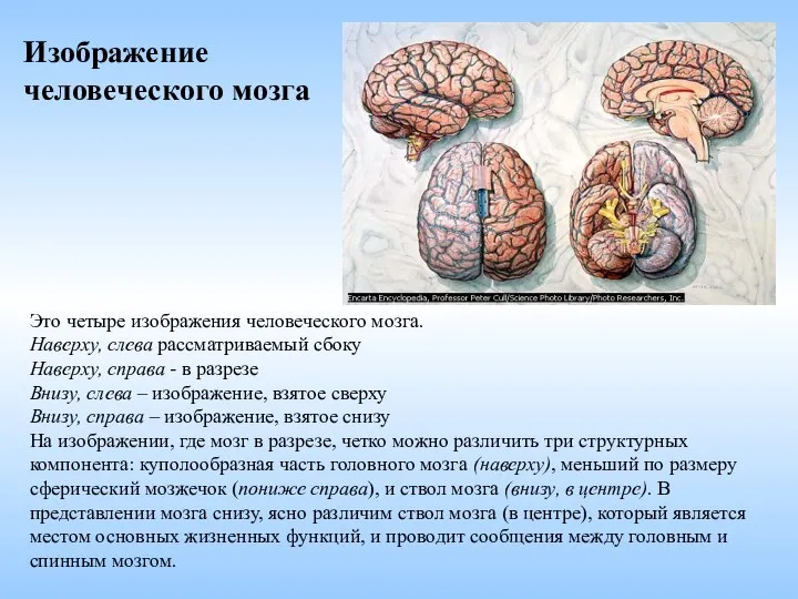 Это четыре изображения человеческого мозга. Наверху, слева рассматриваемый сбоку Наверху, справа