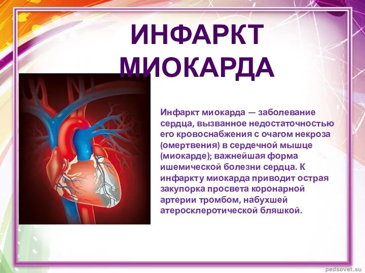 Инфаркт миокарда — заболевание сердца, вызванное недостаточностью его кровоснабжения с очагом